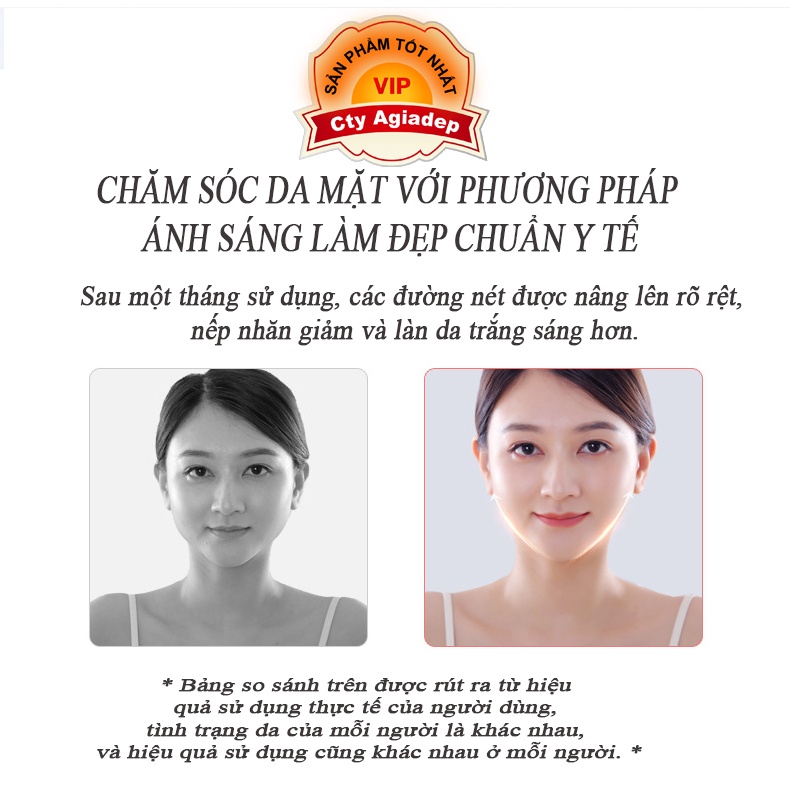 Massage mặt V-line - chăm sóc da công nghệ ánh sáng mới - bền bỉ - cao cấp - Agiadep.com