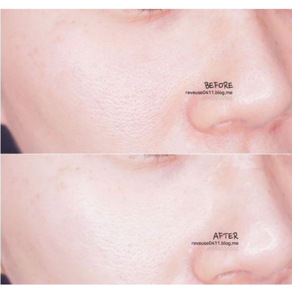 Tinh Chất Tẩy Da Chết Hóa Học So' Natural Red Peel Tingle Serum 35ml | BigBuy360 - bigbuy360.vn
