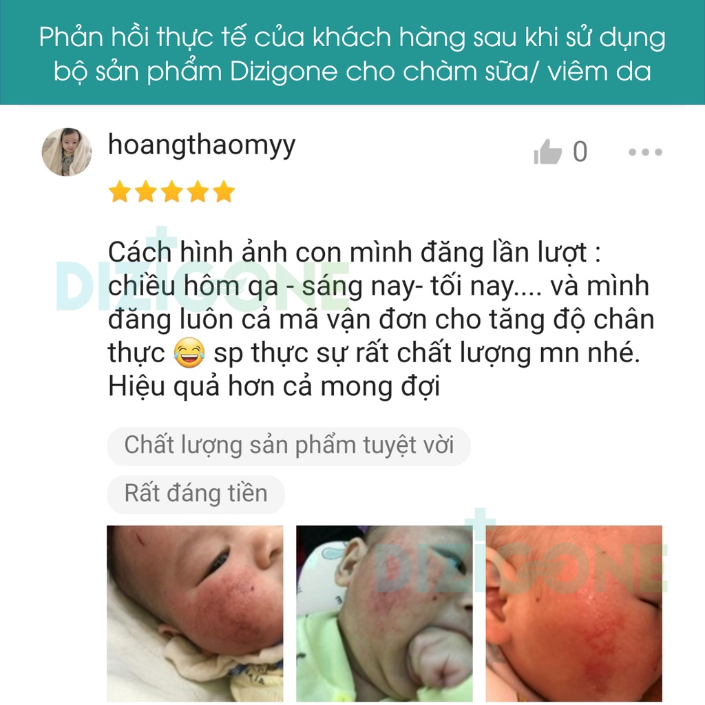 [Bộ đôi] Dung dịch kháng khuẩn DIZIGONE 300ml & Kem DIZIGONE Baby 30g: Đẩy lùi hăm tã, chàm sữa & bảo vệ da bé