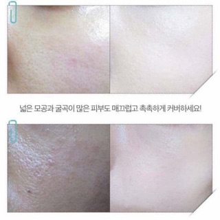 SÉT BỘ PHẤN NƯỚC KARADIUM