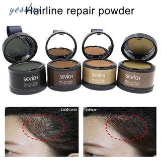 (Hàng Mới Về) Phấn Che Khuyết Điểm Đường Chân Tóc 4g