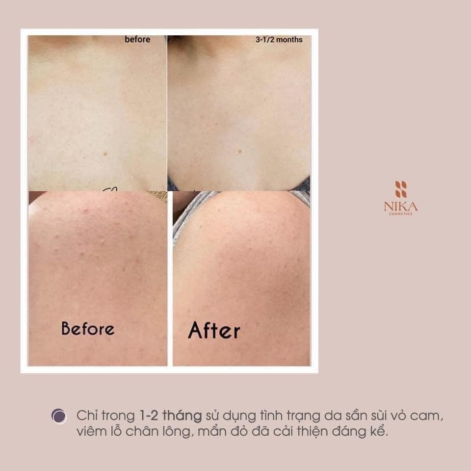 Kem dưỡng body tẩy tế bào chết Paula's Choice Weightless Body Treatment 2% BHA