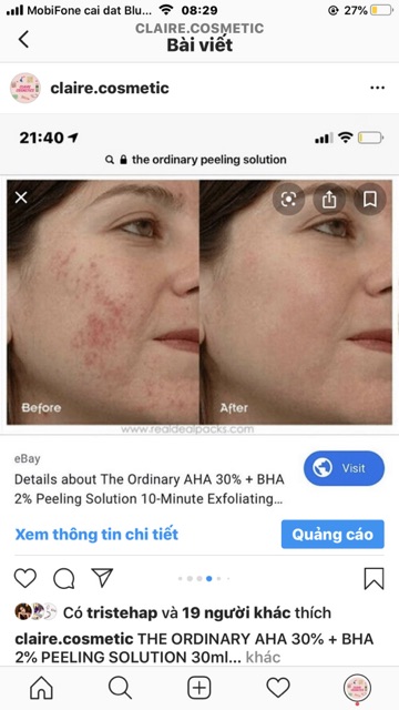 [BILL SEPHORA]THE ORDINARY PEELING SOLUTION AHA BHA TẨY DA CHẾT TẾ BÀO | BigBuy360 - bigbuy360.vn