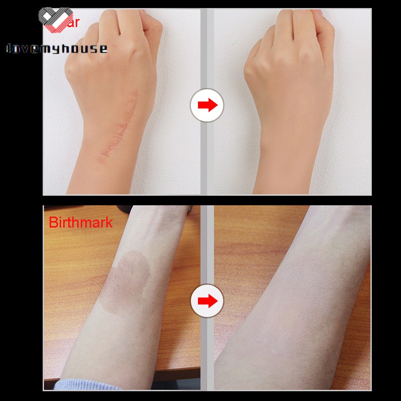 [Hàng mới về] Bộ 2 kem che khuyết điểm da cho hình xăm/vết sẹo/vết bớt