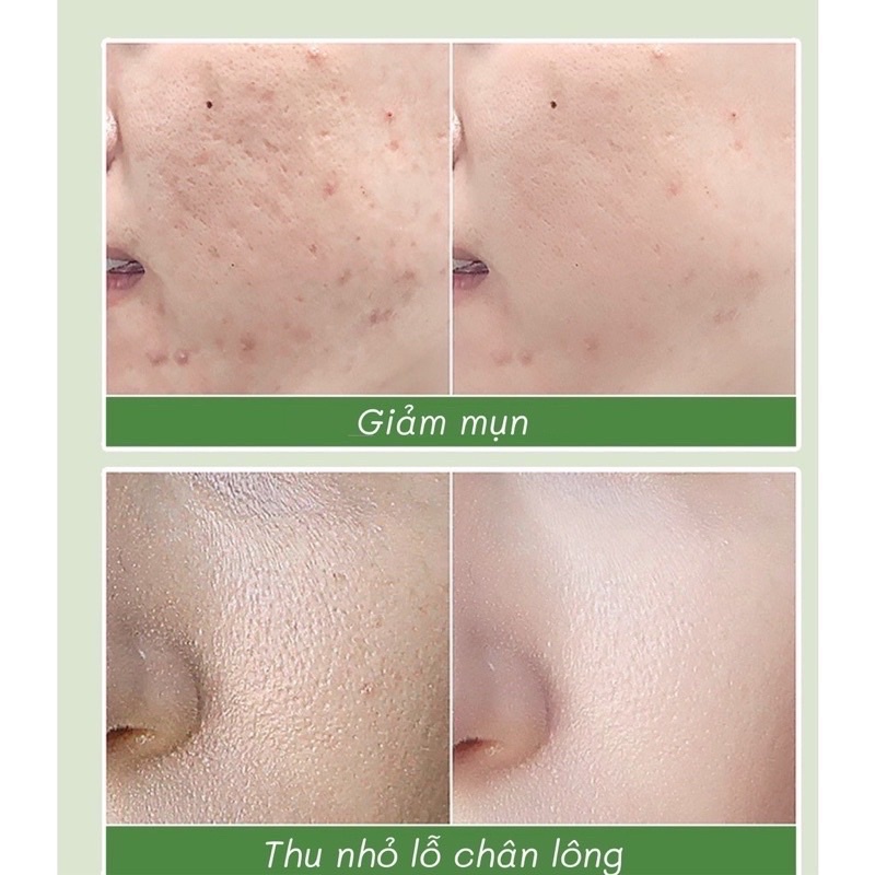 Mặt nạ sủi bọt thải độc cấp ẩm dưỡng trắng da mask GINBI Chính Hãng nội địa Trung