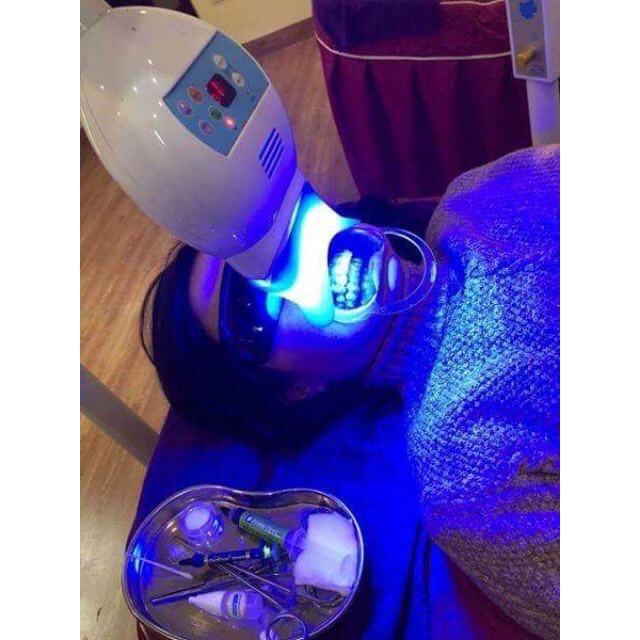 Bộ  Tẩy Trắng Răng (trọn bộ đèn,kính,banh miệng,thuốc)