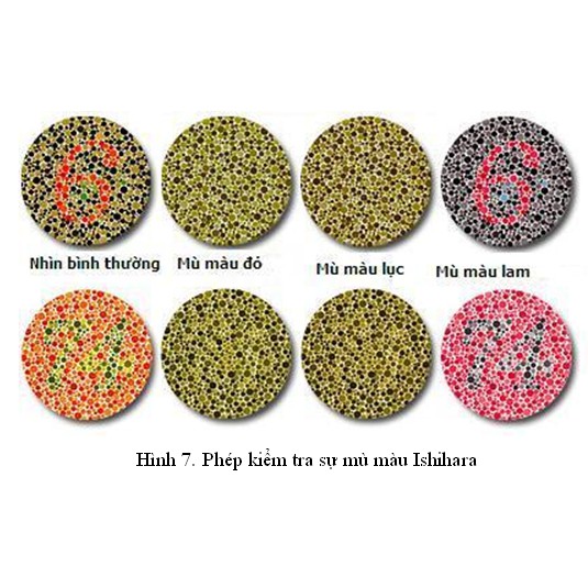 Bảng đo kiểm tra độ mù màu- kiểm tra sắc giác ISHIHARA 38 set
