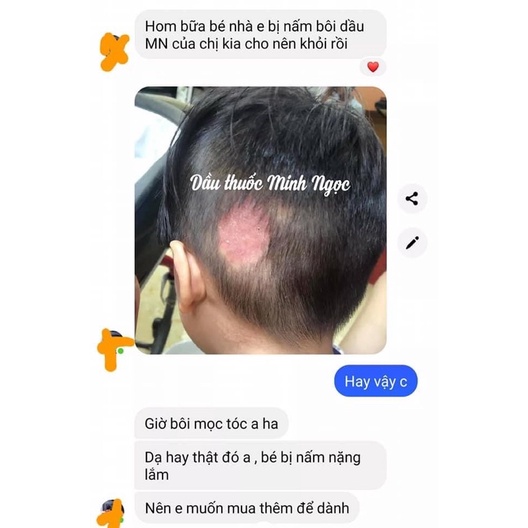 Dầu Minh Ngọc cầm máu, nhanh lành vết thương 30ml- JET Natural Store