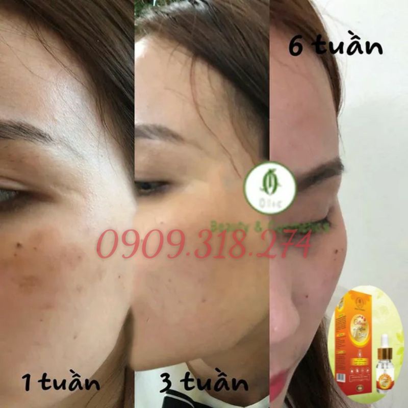 [CHÍNH HÃNG] SERUM COLLAGEN SAFFRON OLIC - kèm phiếu bảo hành