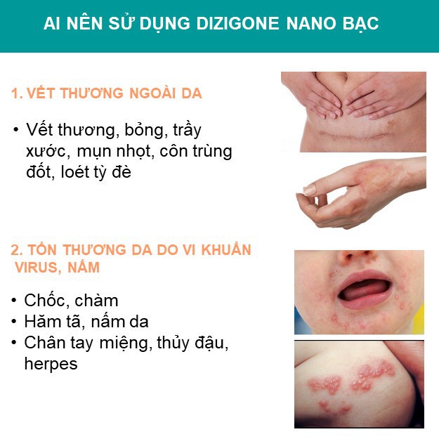 Bộ đôi Dizigone Spray 100ml và Dizigone nano bạc 25g bạc Kháng khuẩn lành vết thương tái tạo da ngăn ngừa sẹo