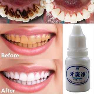 1 Bottle 10 Ml Teeth Whitening Mouth Cleaning Liquid Whitening Dental Bleaching
