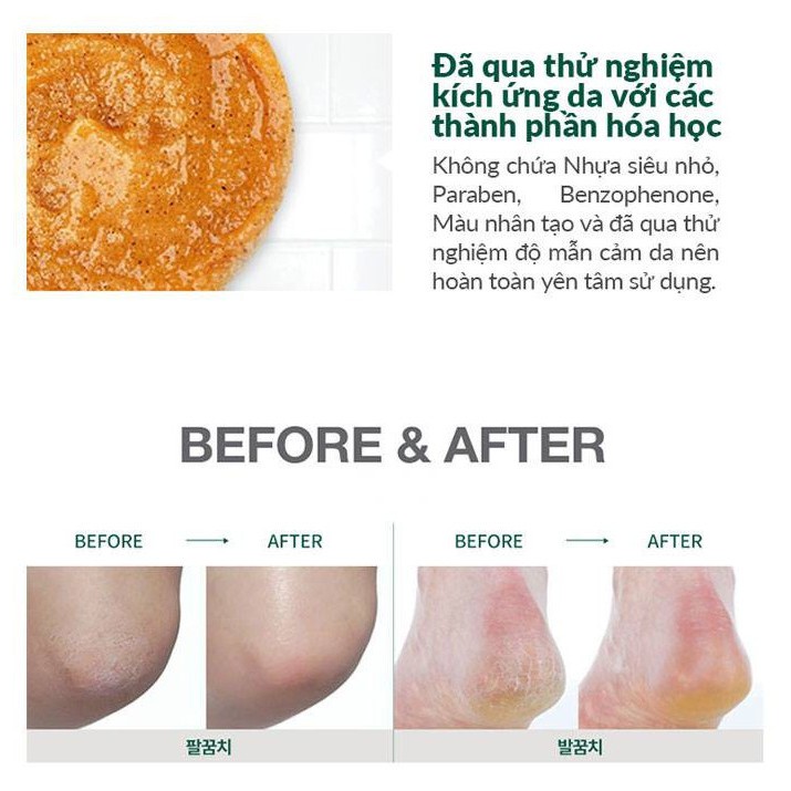 [MEDIHEAL VN] [DATE 9/2022] PLU Body Scrub 200G - Tẩy Tế Bào Chết Toàn Thân Tinh Chất Thiên Nhiên