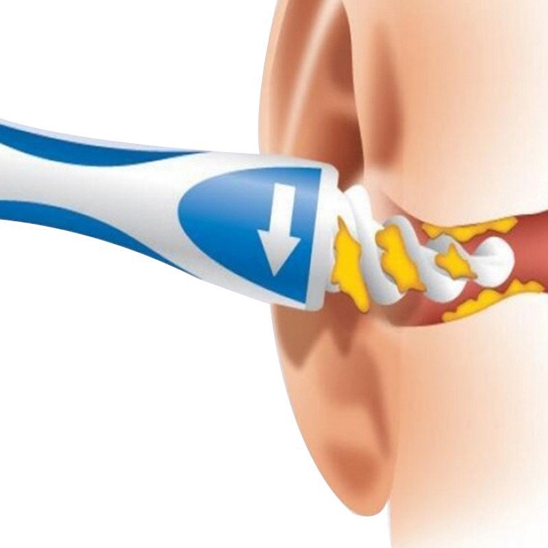 Dụng Cụ Làm Sạch Lấy Rái Tai 16 Đầu Xoắn Ốc Mềm Mại