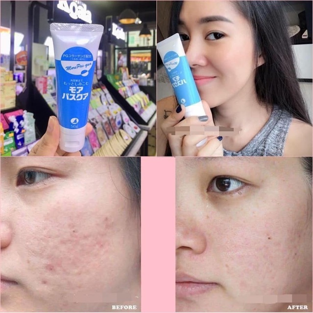 GEL PG COLLAGEN TÁI TẠO DA (MẪU MỚI 80G) | BigBuy360 - bigbuy360.vn