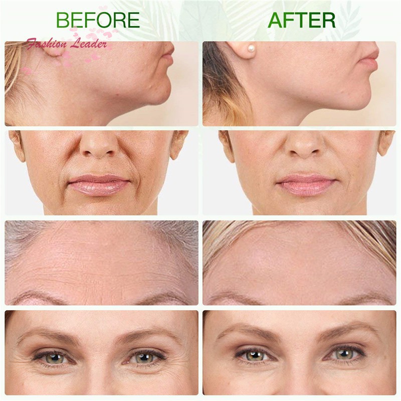 (Hàng Mới Về) Bộ Con Lăn Ngọc Bích Giảm Nếp Nhăn Lão Hóa Làm Đẹp Da | BigBuy360 - bigbuy360.vn