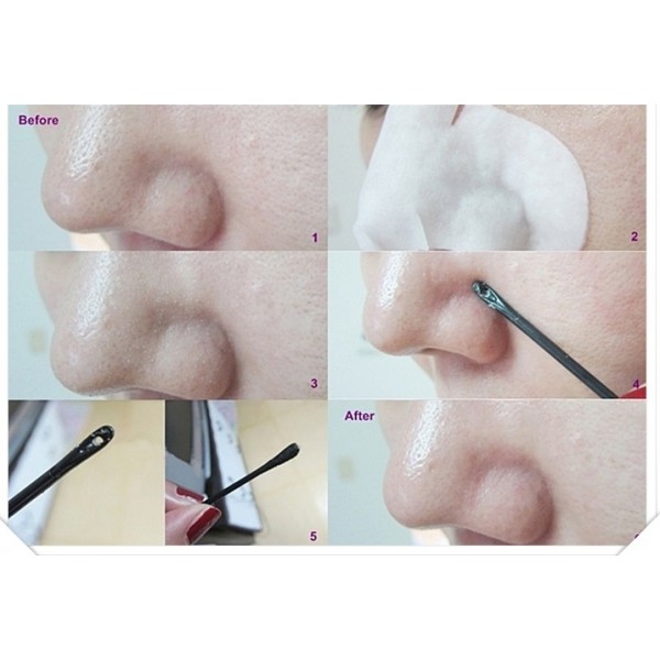 Mặt nạ đẩy mụn đầu đen Ciracle Goodbye Blackhead | Thế Giới Skin Care