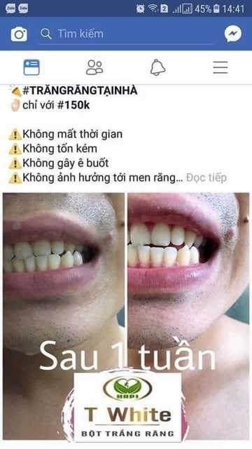 bột trắng răng t white giúp răng sạch mảng bám trên răng sạch , hết hôi miệng , sâu răng , ê buốt