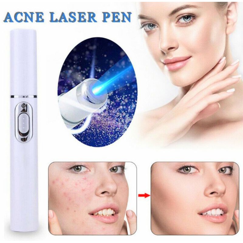 1 MÁY XÓA MỤN SẸO BẰNG LASER CHĂM SÓC DA NHỎ GỌN TIỆN DỤNG MẪU MỚI CHẤT LƯỢNG TỐT