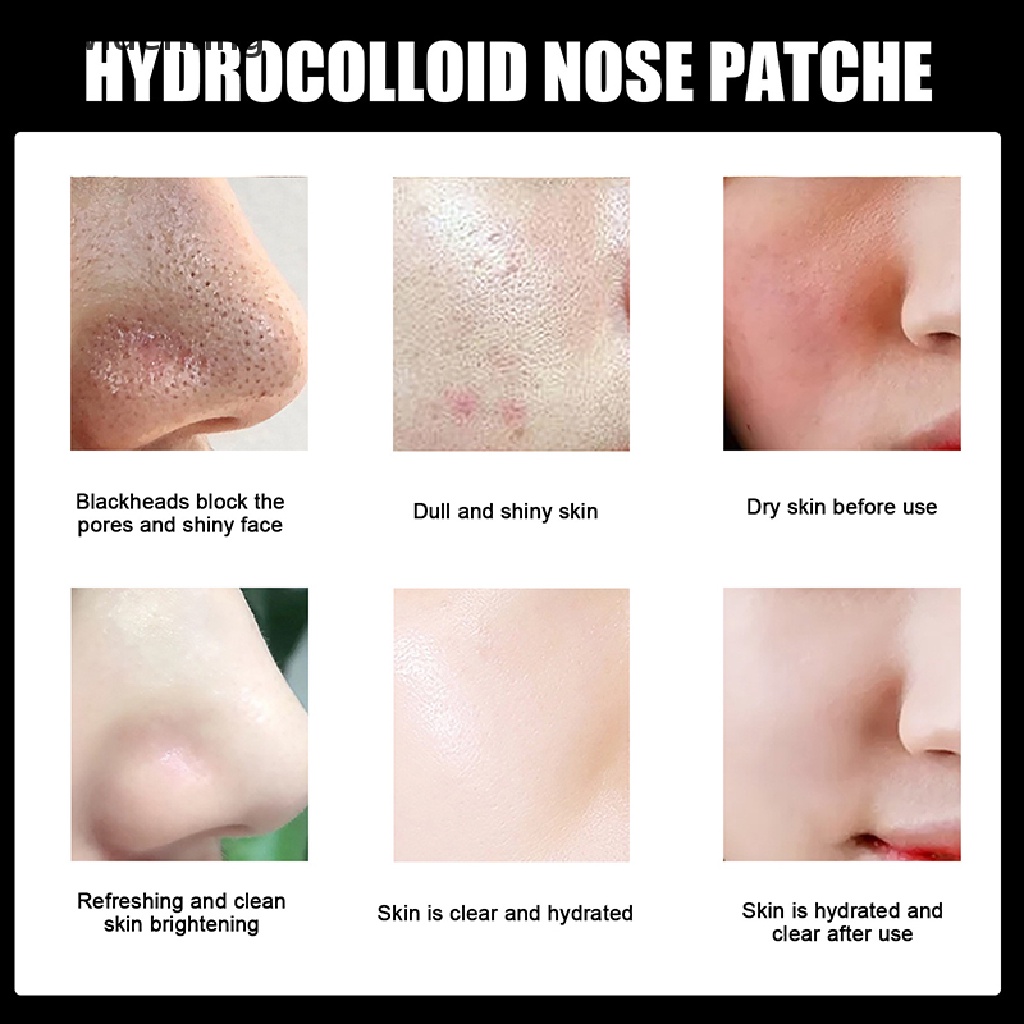 [Hàng mới về] Set 10 miếng dán mũi lột mụn đầu đen hydrocolloid làm sạch sâu se khít lỗ chân lông chăm sóc làn da