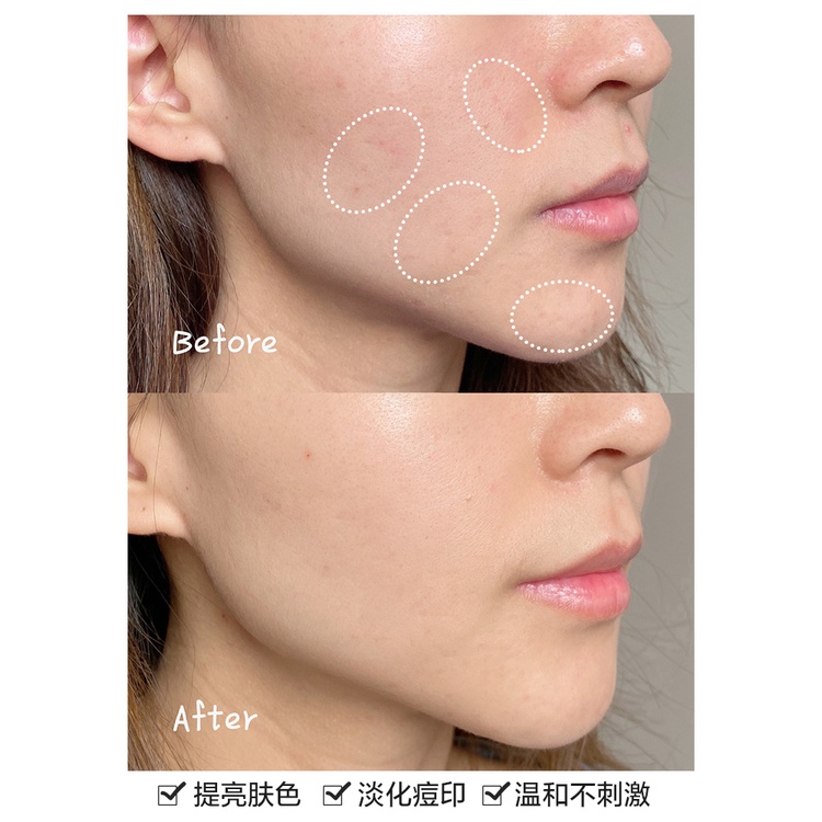 Tinh Chất Clinique 302 Giúp Dưỡng Trắng Da 50ml/100ml Cao Cấp