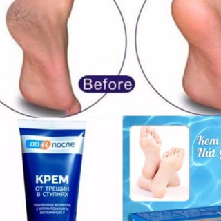 NDS Kem dưỡng da chân