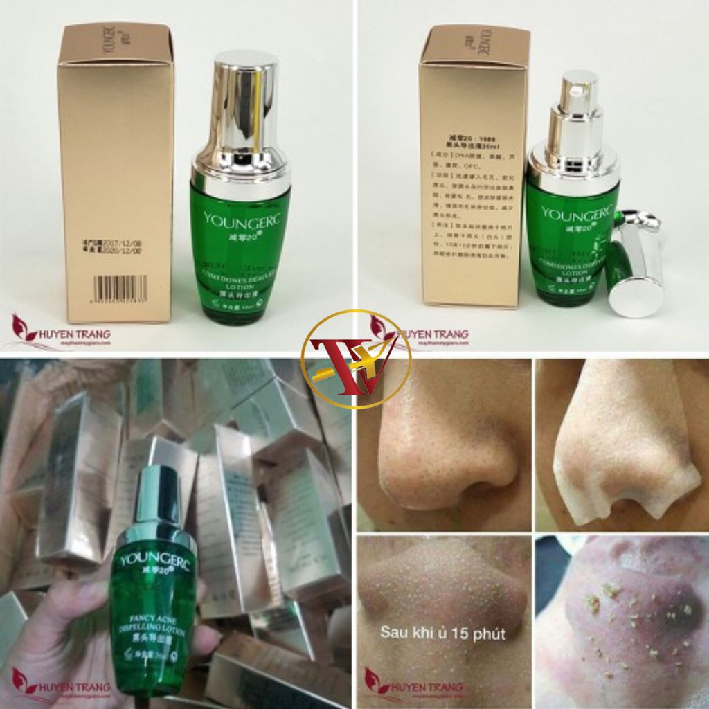 Ủ Mụn Đầu Đen - Mụn Cám Chuyên Dụng | BigBuy360 - bigbuy360.vn