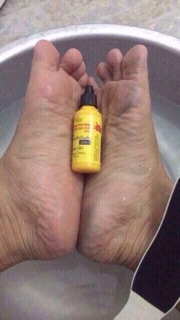 BỘ CHÀ GÓT CHÂN BIG CARE
