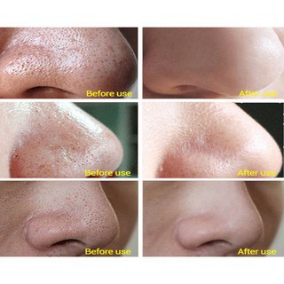 [Hàng Loại 1] Máy Hút Mụn RT8080,8030 Siêu Sạch Với  Cấp Độ Làm Căn Da Xóa Nếp Nhăn - Màu Hồng Da | BigBuy360 - bigbuy360.vn