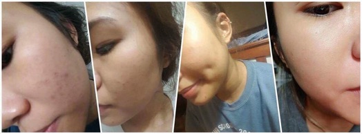 Face Pháp (Kem mặt trắng da Acosmetics)