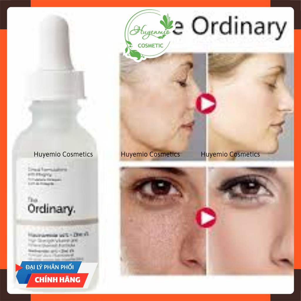 The Ordinary Niacinamide 10% + Zinc 1% Tinh chất giảm mụn thâm - 30ml [CHÍNH HÃNG] | BigBuy360 - bigbuy360.vn