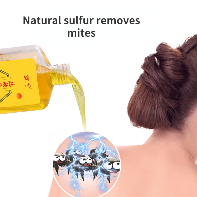 Xà Phòng Lưu Huỳnh Hỗ Trợ Giảm Mụn Kiểm Soát Dầu Chăm Sóc Da Toàn Thân