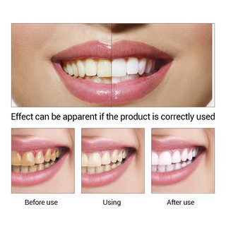 Serum làm trắng răng hãng LANBENA