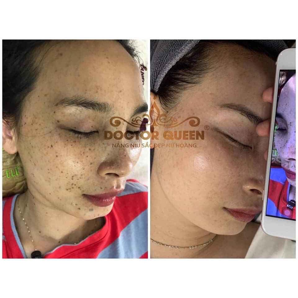 KEM NÁM DOCTOR QUEEN--