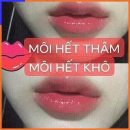 SON Ủ MÔI SHI - MỀN MÔI -DƯỠNG MÔI - HỒNG MÔI - TRỊ THÂM MÔI V V V