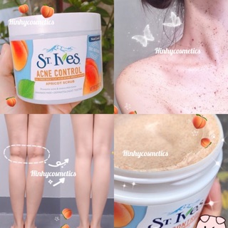 Tẩy Da Chết Body Stives