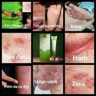 Gel Bôi Da Phú Kang