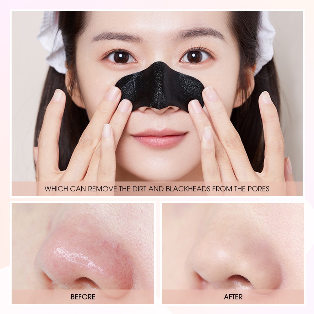 Mặt Nạ Lột Mụn Đầu Đen Làm Sạch Sâu Lỗ Chân Lông