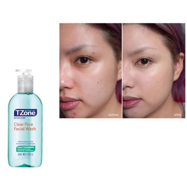 [200ml] Sữa Rửa Mặt Dạng Gel Chiết Xuất Tràm Trà Newtons Labs T-Zone Clear Pore Facial Wash | BigBuy360 - bigbuy360.vn