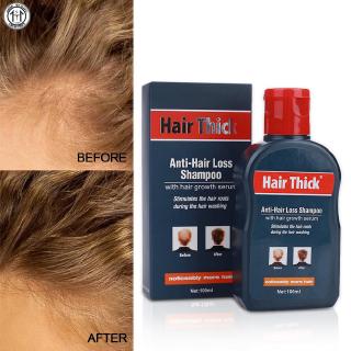 [Hàng mới về] Dầu gội kích thích mọc tóc nhanh 100ml