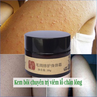 [100% Hàng nội địa chính hãng ] Kem bôi viêm nang lông - viêm lỗ chân lông