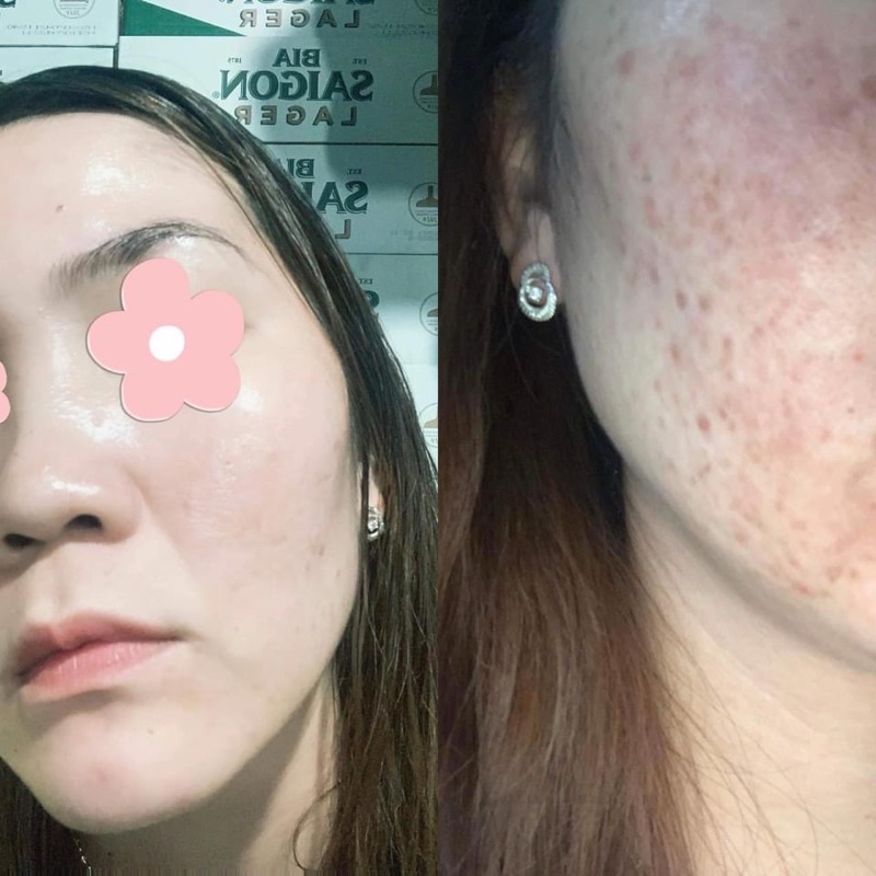 Kẹo Ngậm Trắng Da - Hủy Nám 6S Shining Pearl Chuẩn Nội Địa Hàn Quốc.