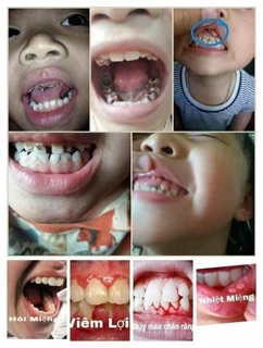 THUỐC ĐÔNG Y NHẬT DƯƠNG
