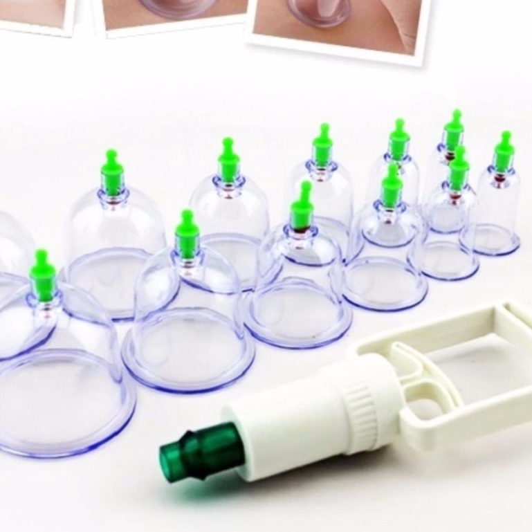 Bộ giác hơi hút chân không 12 món không dùng lửa an toàn, dụng cụ giác hơi tại nhà 12 ống ly cốc nhựa hút mụn, máu bầm