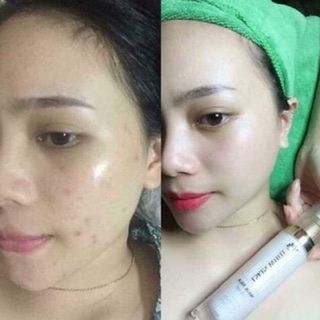 Ủ kén tằm LSKIN