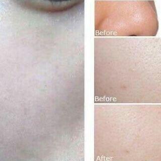 Serum Se Lỗ Chân Lông (estee lauder idealist Pore Minimizing)