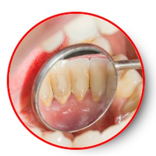 [Sốc] Máy trắng răng cao cấp Nhật Bản