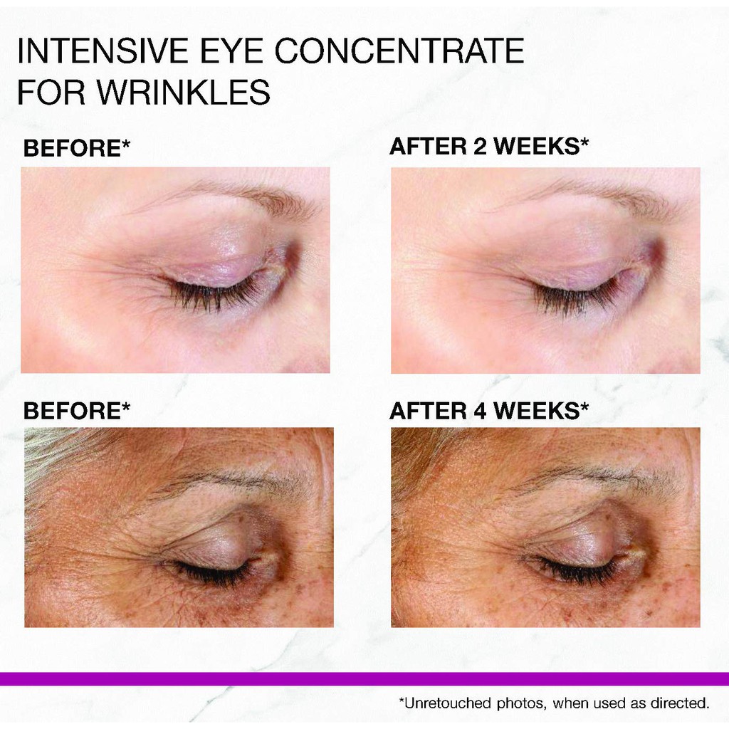 Strivectin ✨ Kem dưỡng mắt ngăn ngừa lão hóa cho mắt NEW Intensive Eye Concentrate for Wrinkles PLUS