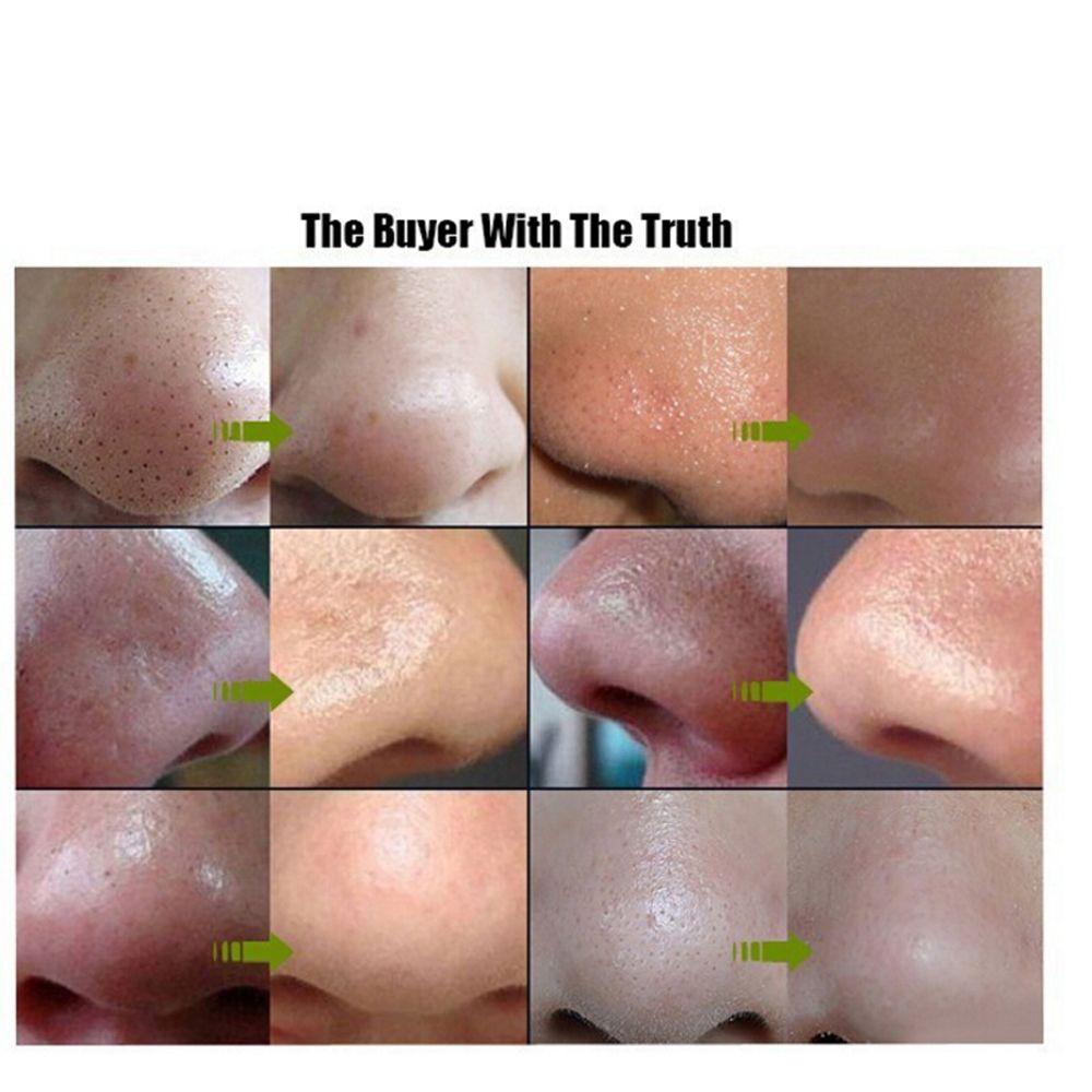 [Hàng mới về] Set 10/20/50/100 miếng dán mũi lột mụn đầu đen/trắng siêu chắc chất lượng cao