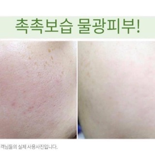 [Hàng Có Sẵn] TUÝP 50ml kem dưỡng dr.ag