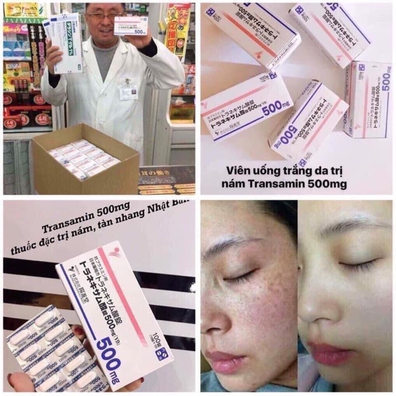 Viên uống trắng da, mờ thâm nám Transamin 500mg 100 viên Nhật Bản
